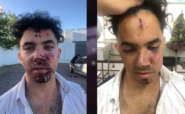 Brutal golpiza a un joven en San Martin por 7 patovicas